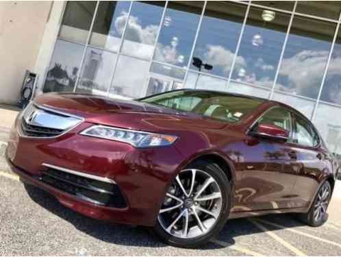 Acura TLX 3. 5L V6 (2015)